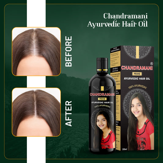 Chandramani Prime Ayurvedic Hair Oil